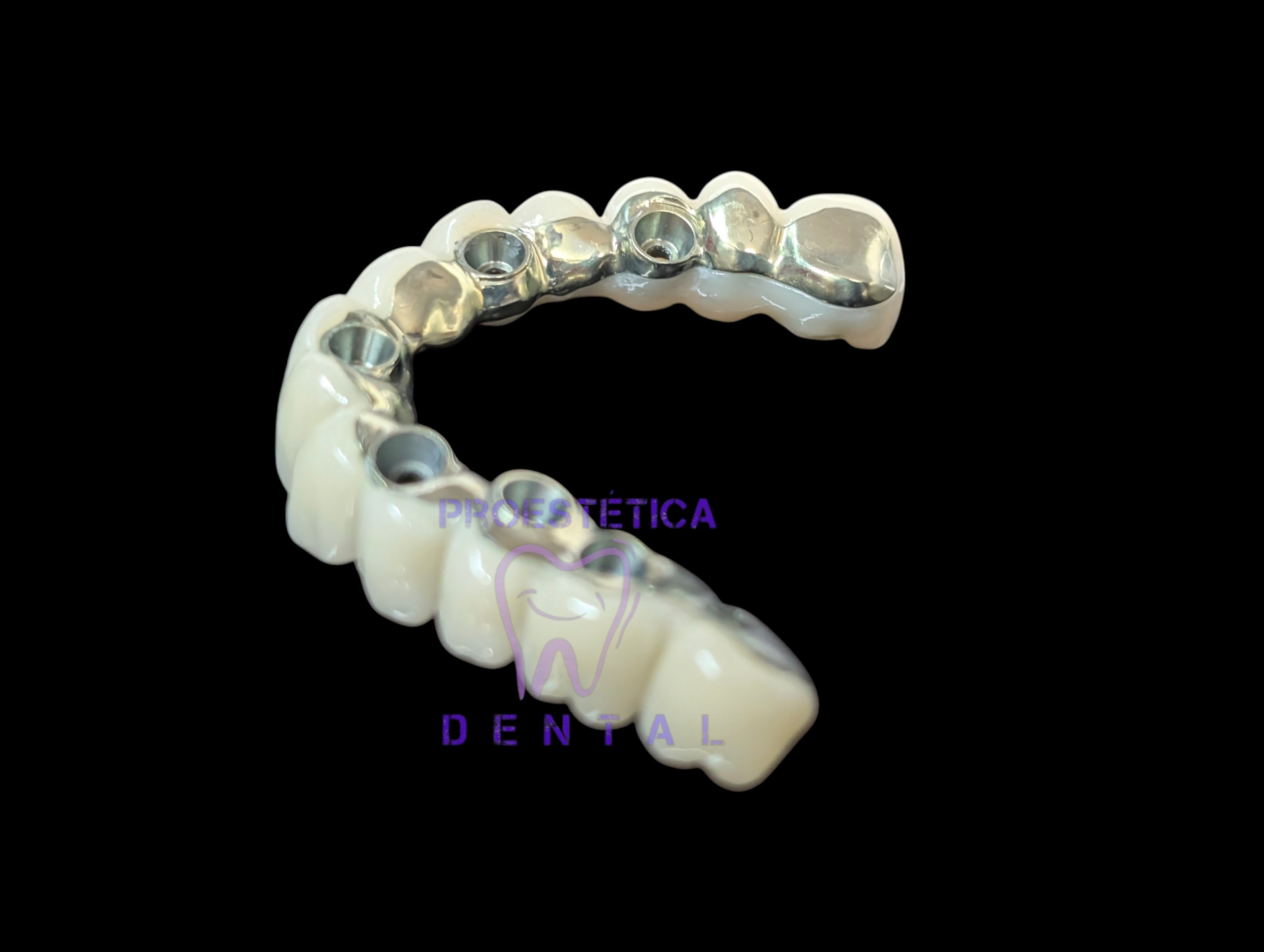Híbrida PMMA con encía composite